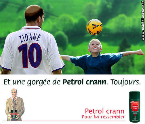 Zidane-et-la-calvitie